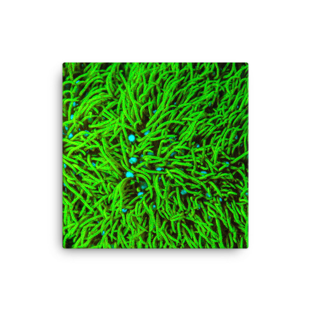 Greener Pastures  - Canvas - Coral Reef Photography Art