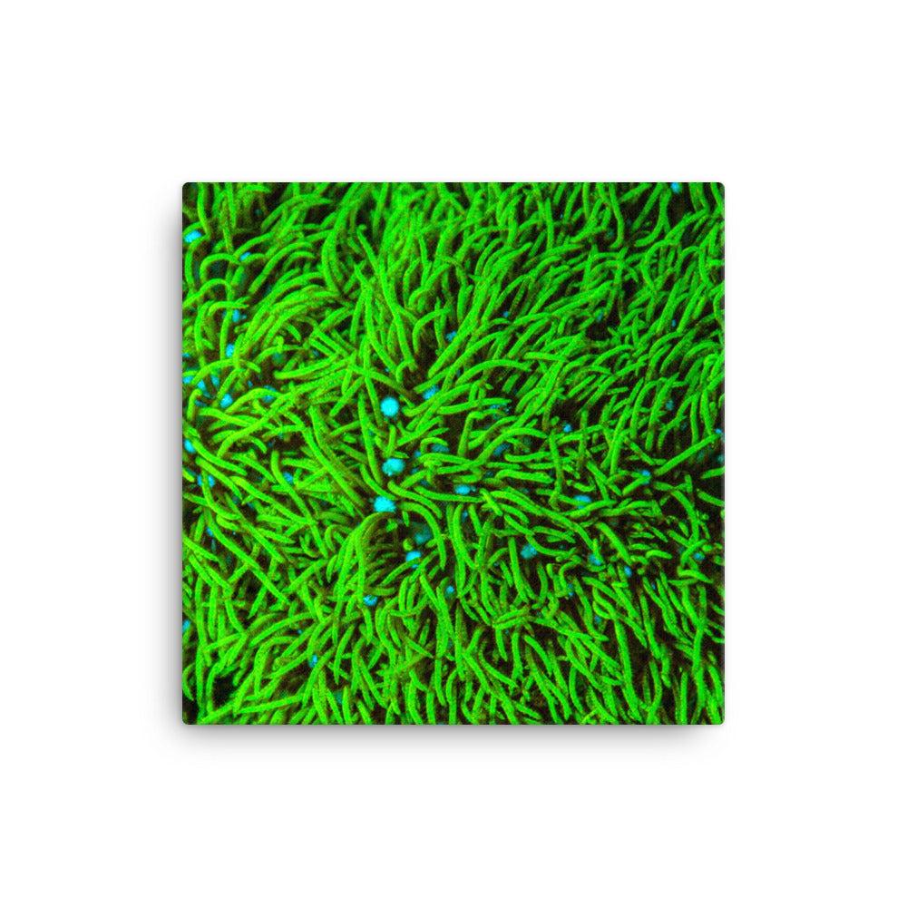 Greener Pastures  - Canvas - Coral Reef Photography Art