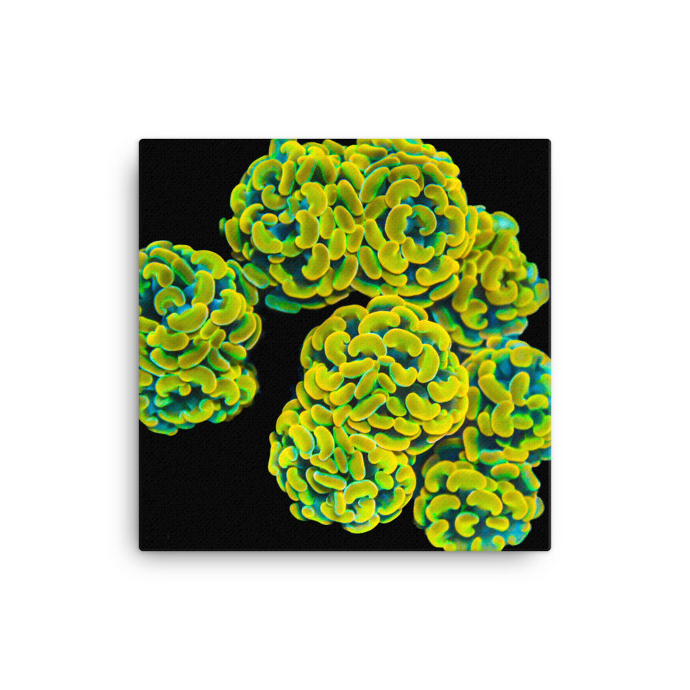Mystic Marigolds - Canvas - Coral Reef Photography Art