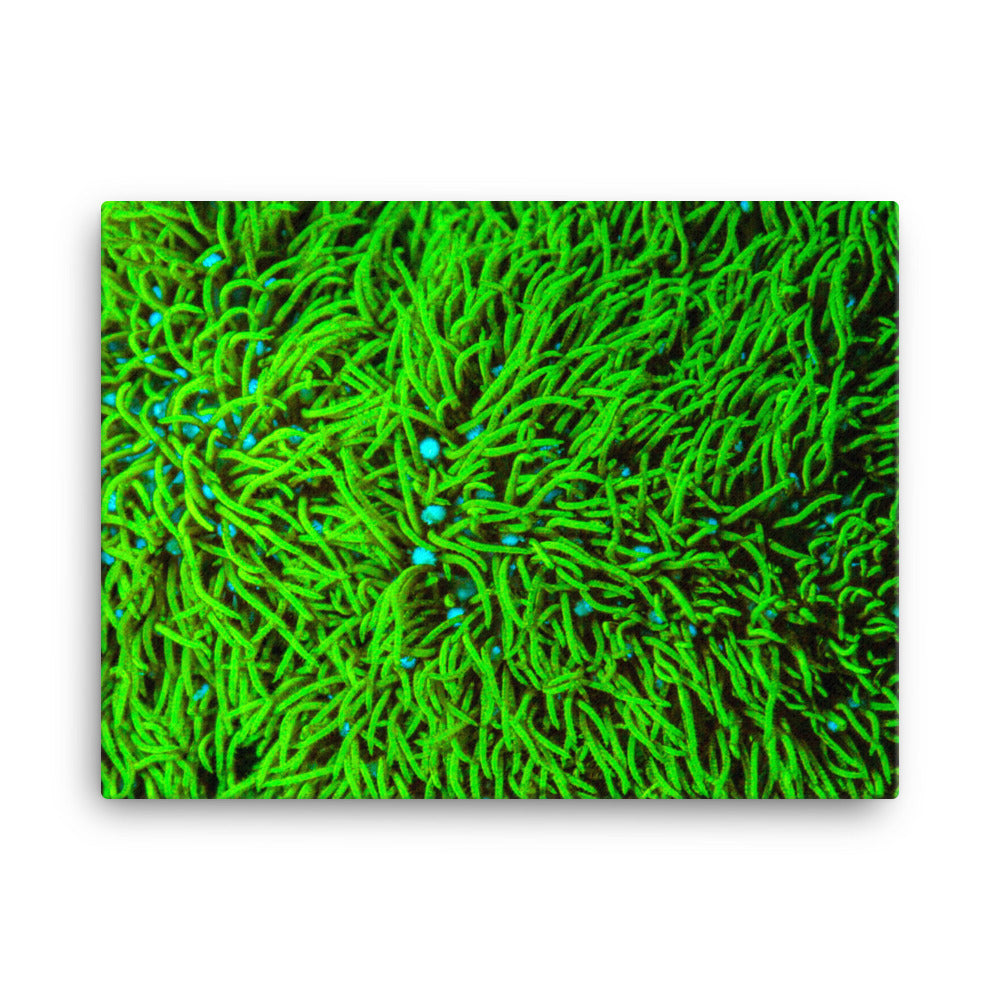 Greener Pastures  - Canvas - Coral Reef Photography Art