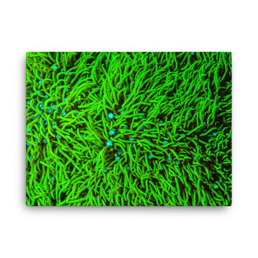 Greener Pastures  - Canvas - Coral Reef Photography Art
