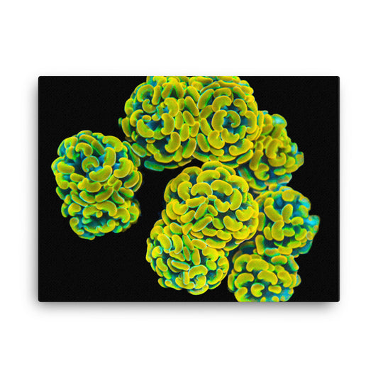 Mystic Marigolds - Canvas - Coral Reef Photography Art