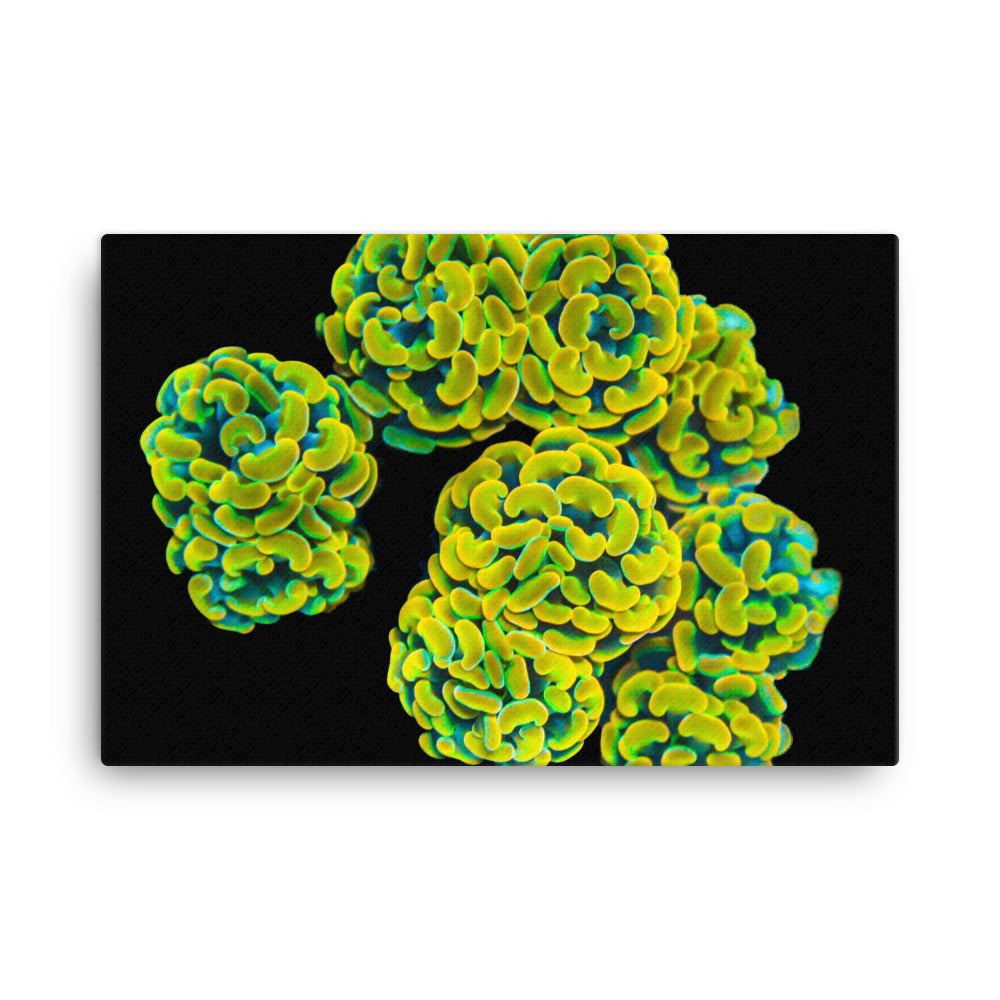 Mystic Marigolds - Canvas - Coral Reef Photography Art
