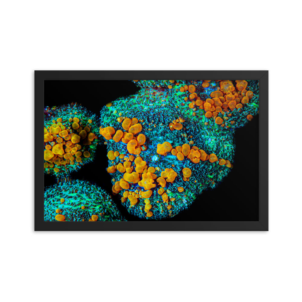 Breakout - Framed Fine Art Print - Coral Reef Photography Art