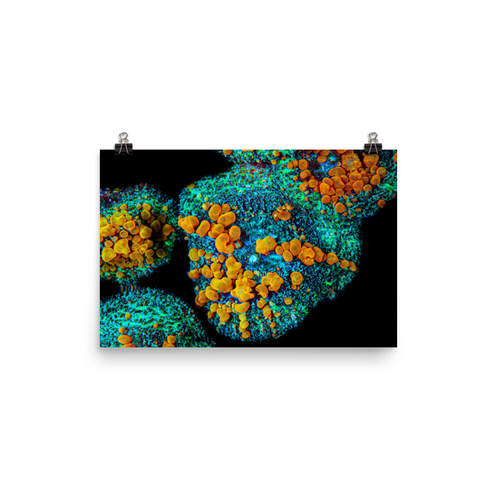 Breakout - Fine Art Print - Coral Reef Photography Art